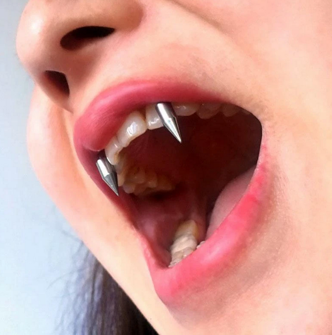 Dracula Fangs / Spikes (5pcs)